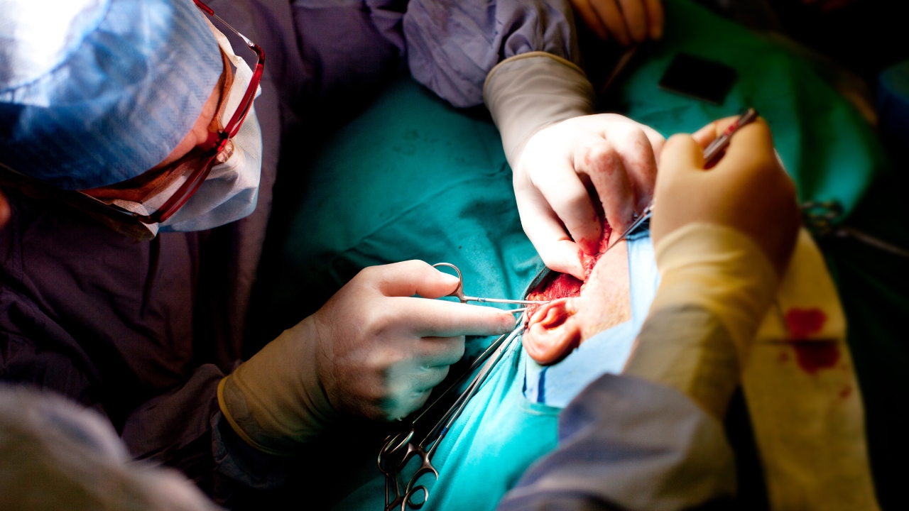 Peritoneal Surface Malignancy & Cytoreductive Surgery